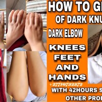 Permanent Skin Bleaching And Whitening Products In Eyrarbakki Village in Iceland Call +27710732372